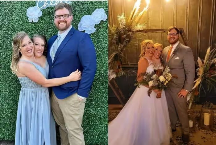 Conjoined Twins Abby and Brittany Hensel Spotted Out After Wedding Josh Bowling