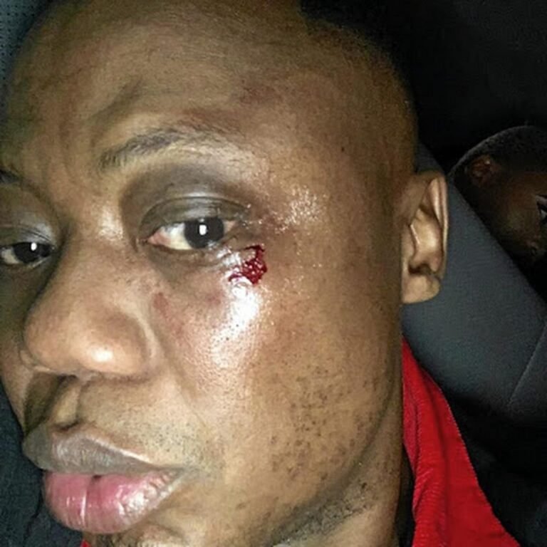 Breaking News: DJ Tira Hit By A Stray Bullet- Video Breaking News: DJ Tira Hit By A Stray Bullet- Video