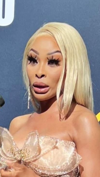 Plastic surgery gone wrong? Khanyi Mbau’s new look scares fans. Plastic surgery gone wrong? Khanyi Mbau’s new look scares fans.